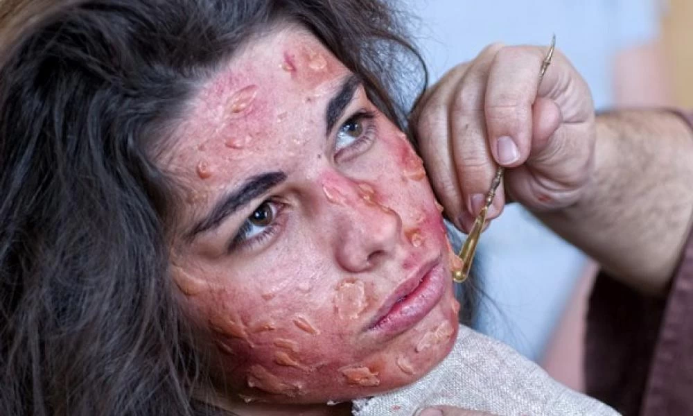 Δείτε ποια είναι η παλαιότερη ασθένεια στον κόσμο!
